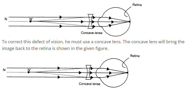 MP Board Class 10th Science Solutions Chapter 11 Human Eye and ...